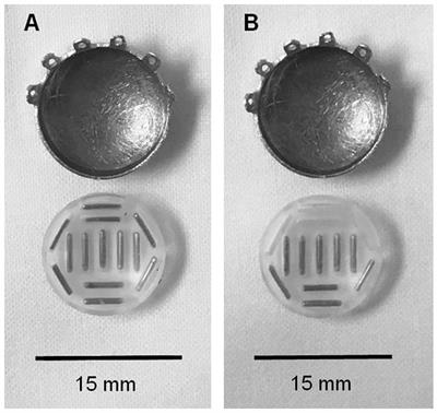 Early treatment and toxicity outcomes for small posterior uveal melanomas treated using custom loaded eye plaques